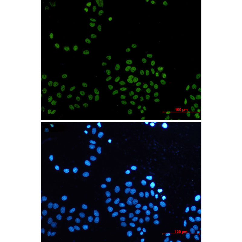 CDK9 Rabbit mAb