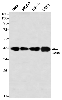 CDK9 Rabbit mAb