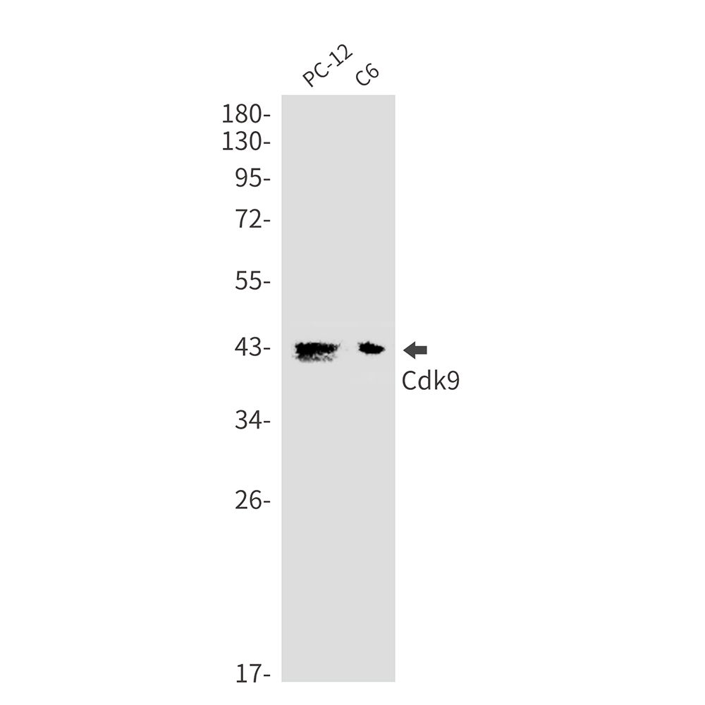 CDK9 Rabbit mAb