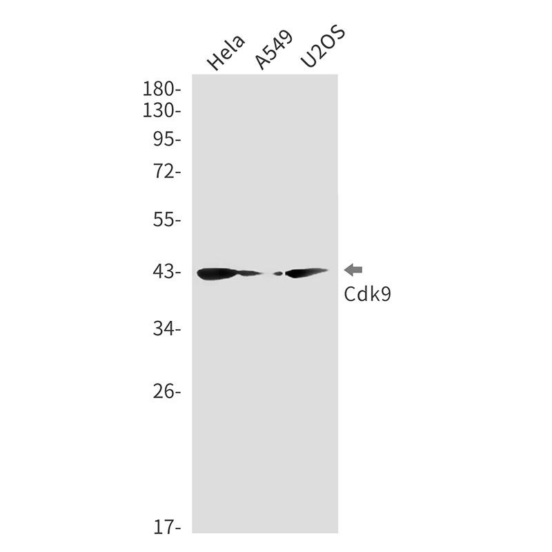 CDK9 Rabbit mAb