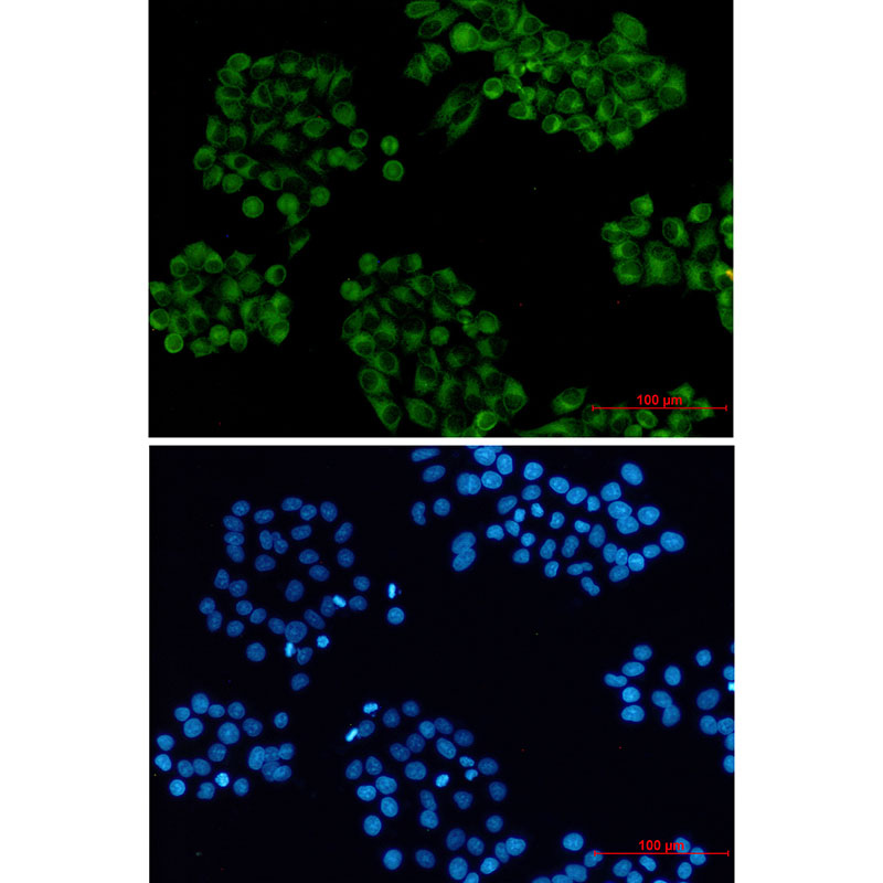 Cellubrevin Rabbit mAb