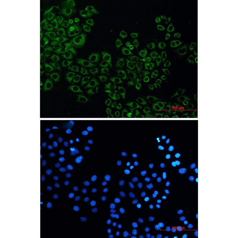 Citrate Synthetase Rabbit mAb