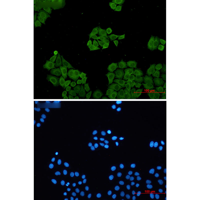 CLIC1 Rabbit mAb