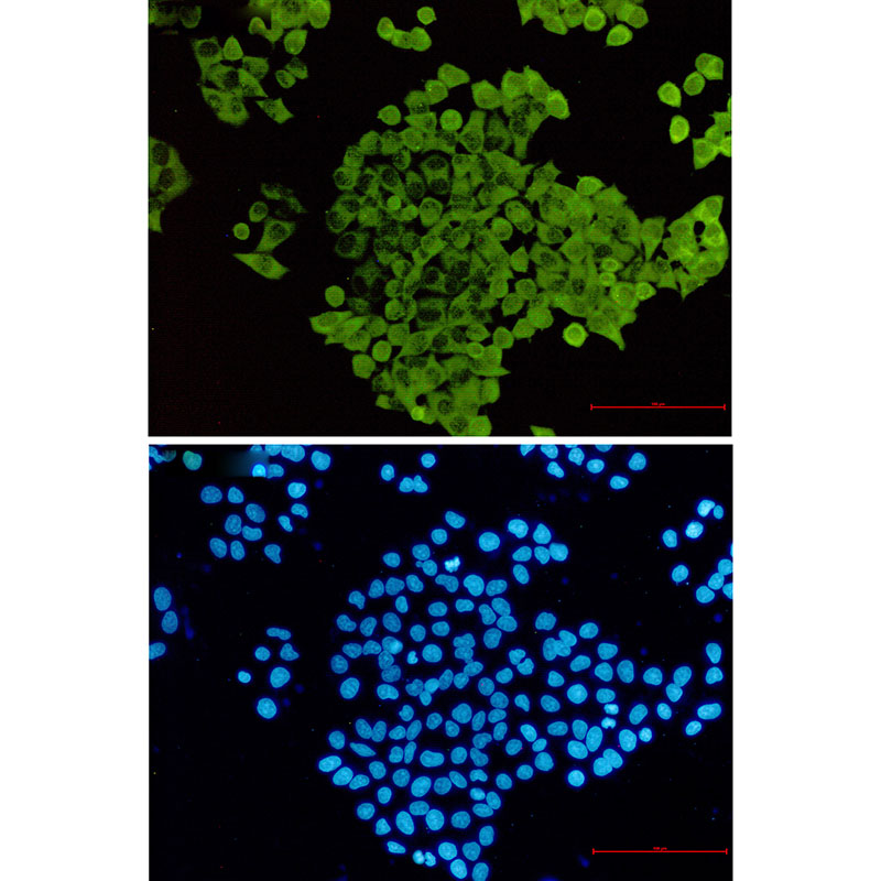 Cofilin Rabbit mAb