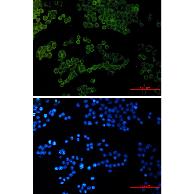 Collagen I alpha 1 Rabbit mAb