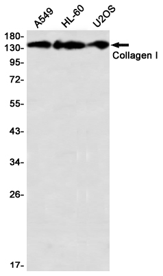 Collagen I alpha 1 Rabbit mAb