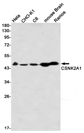 CSNK2A1 Rabbit mAb