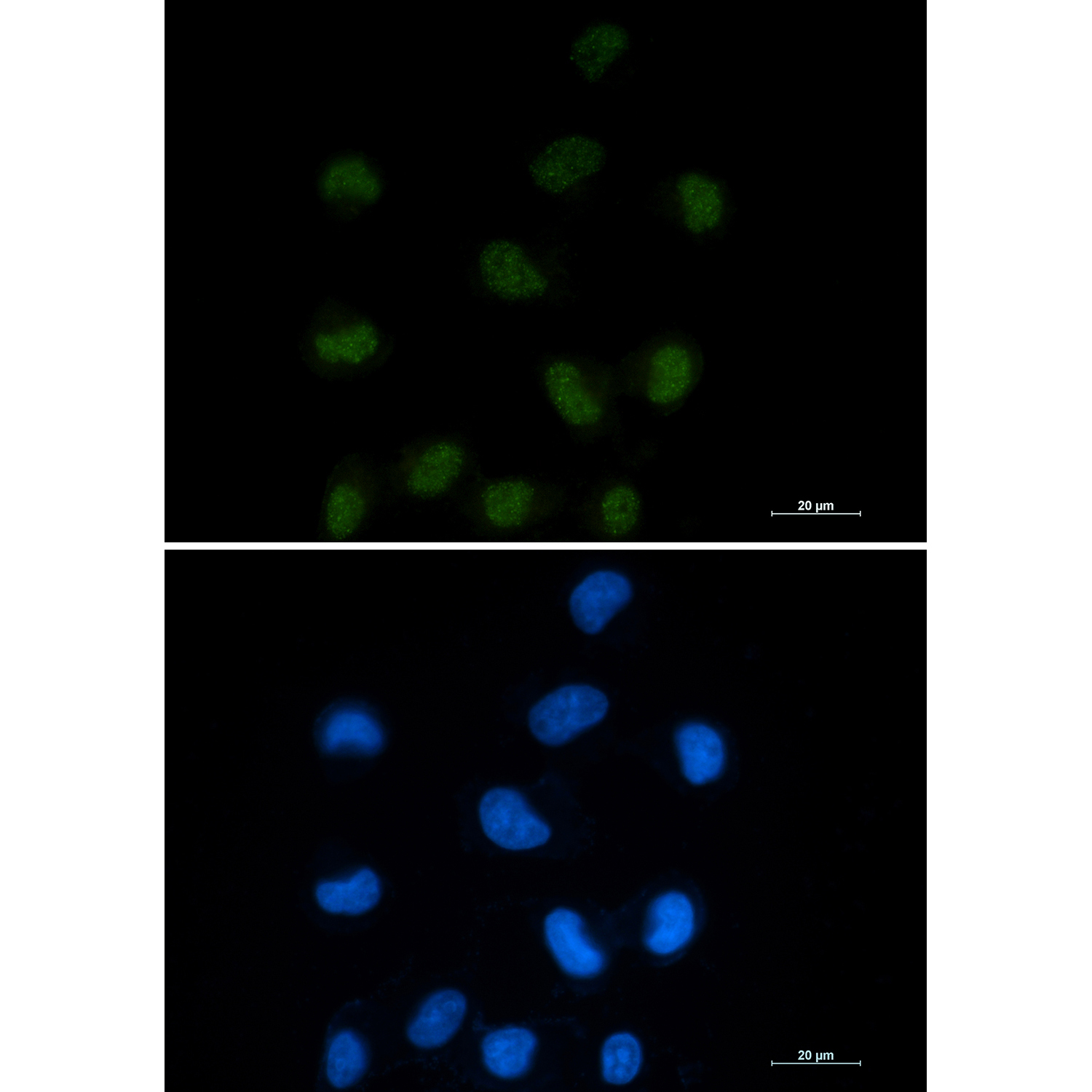 CTBP1 Rabbit mAb