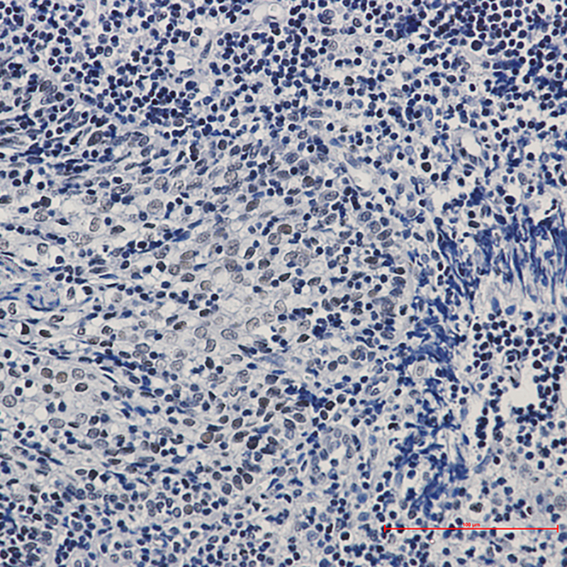 CTBP1 Rabbit mAb