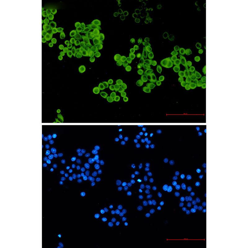 Cytochrome P450 2D6 Rabbit mAb