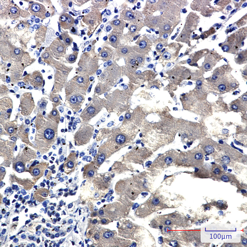 Cytochrome P450 2D6 Rabbit mAb