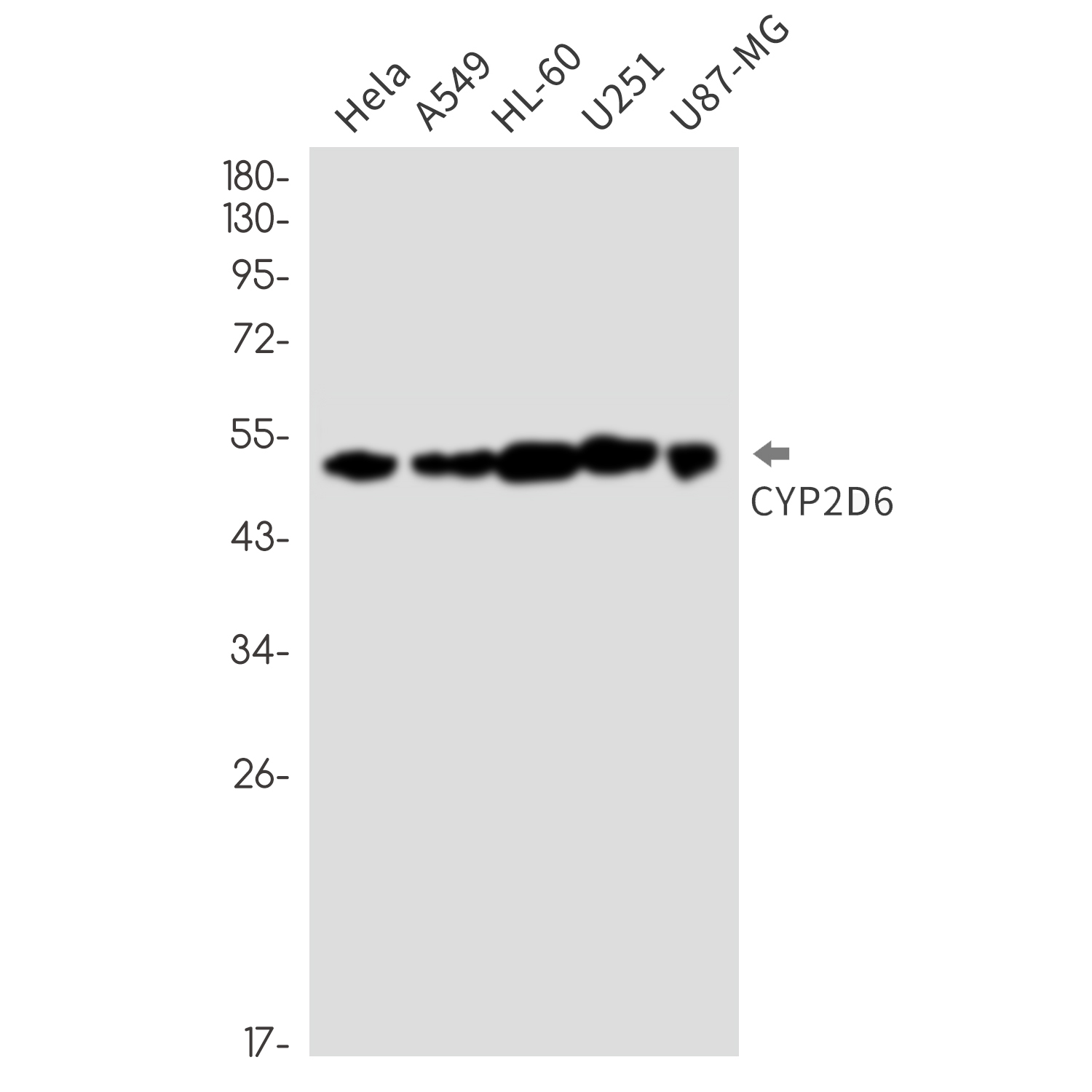 Cytochrome P450 2D6 Rabbit mAb