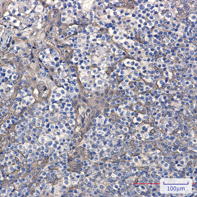 Cystatin B Rabbit mAb