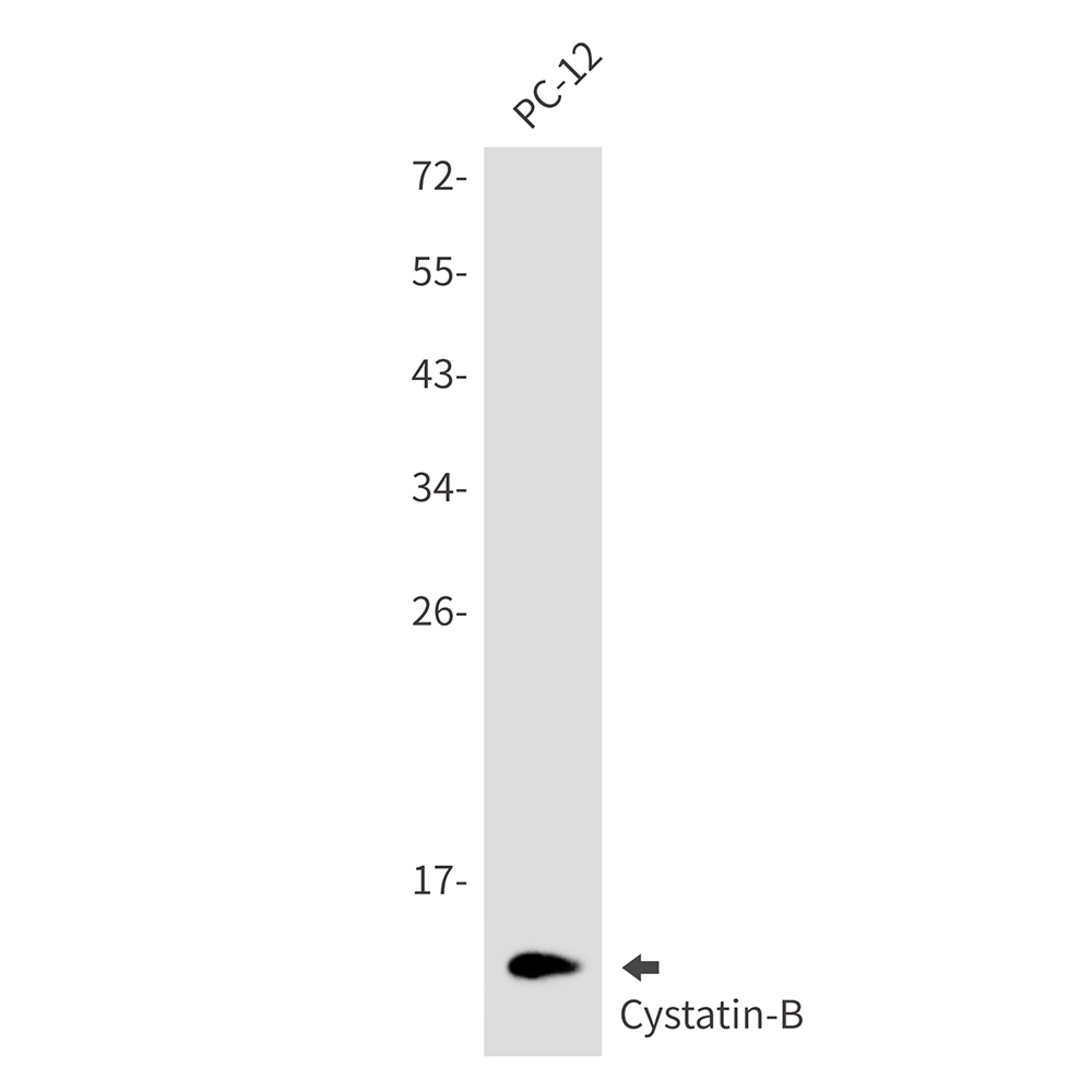 Cystatin B Rabbit mAb