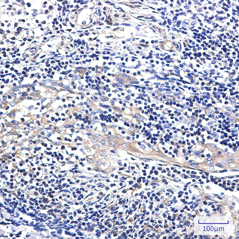 EBP1 Rabbit mAb