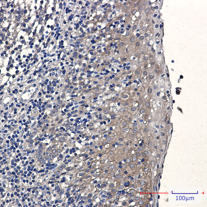 Elongation Factor 1A1 Rabbit mAb