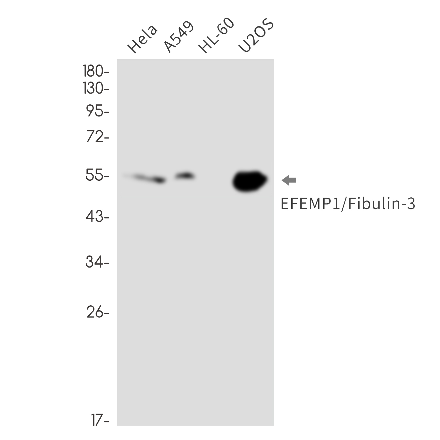 EFEMP1 Rabbit mAb