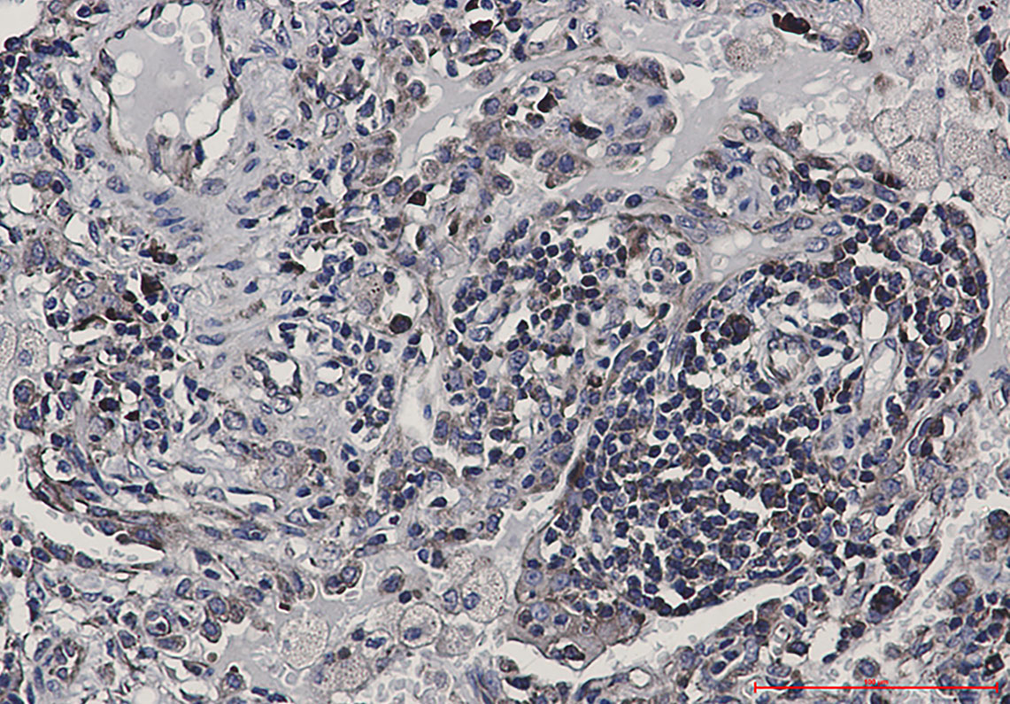 eIF4B Rabbit mAb