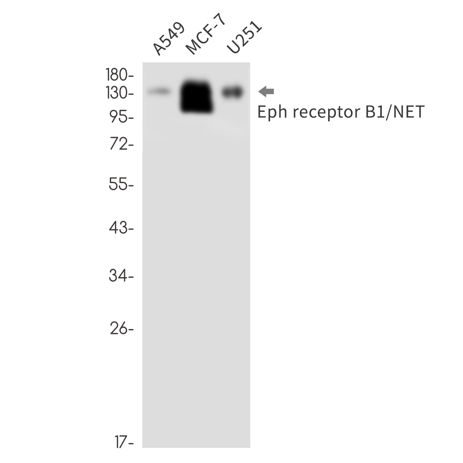 Ephrin Receptor B1 Rabbit mAb