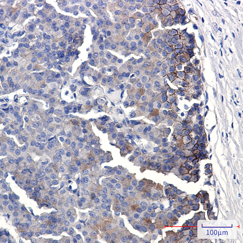 Ephrin Receptor B4 Rabbit mAb