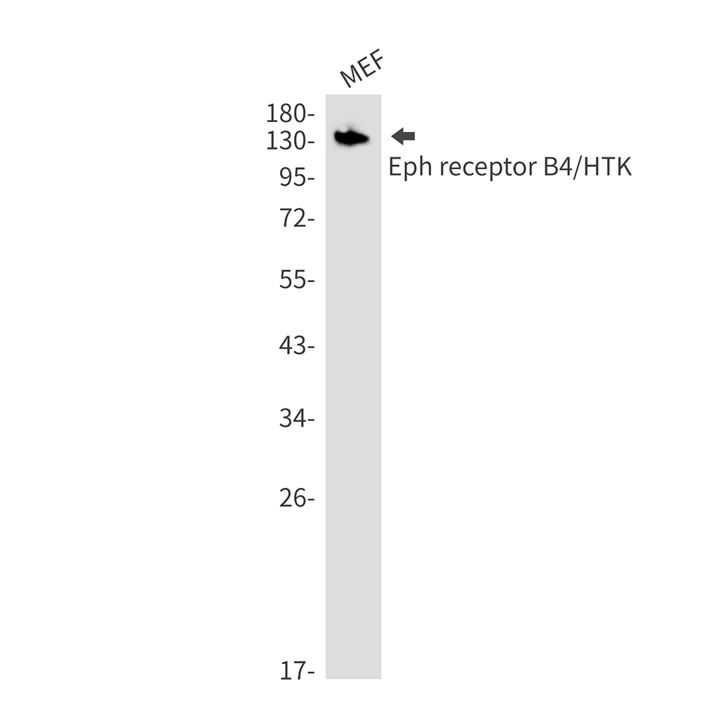 Ephrin Receptor B4 Rabbit mAb