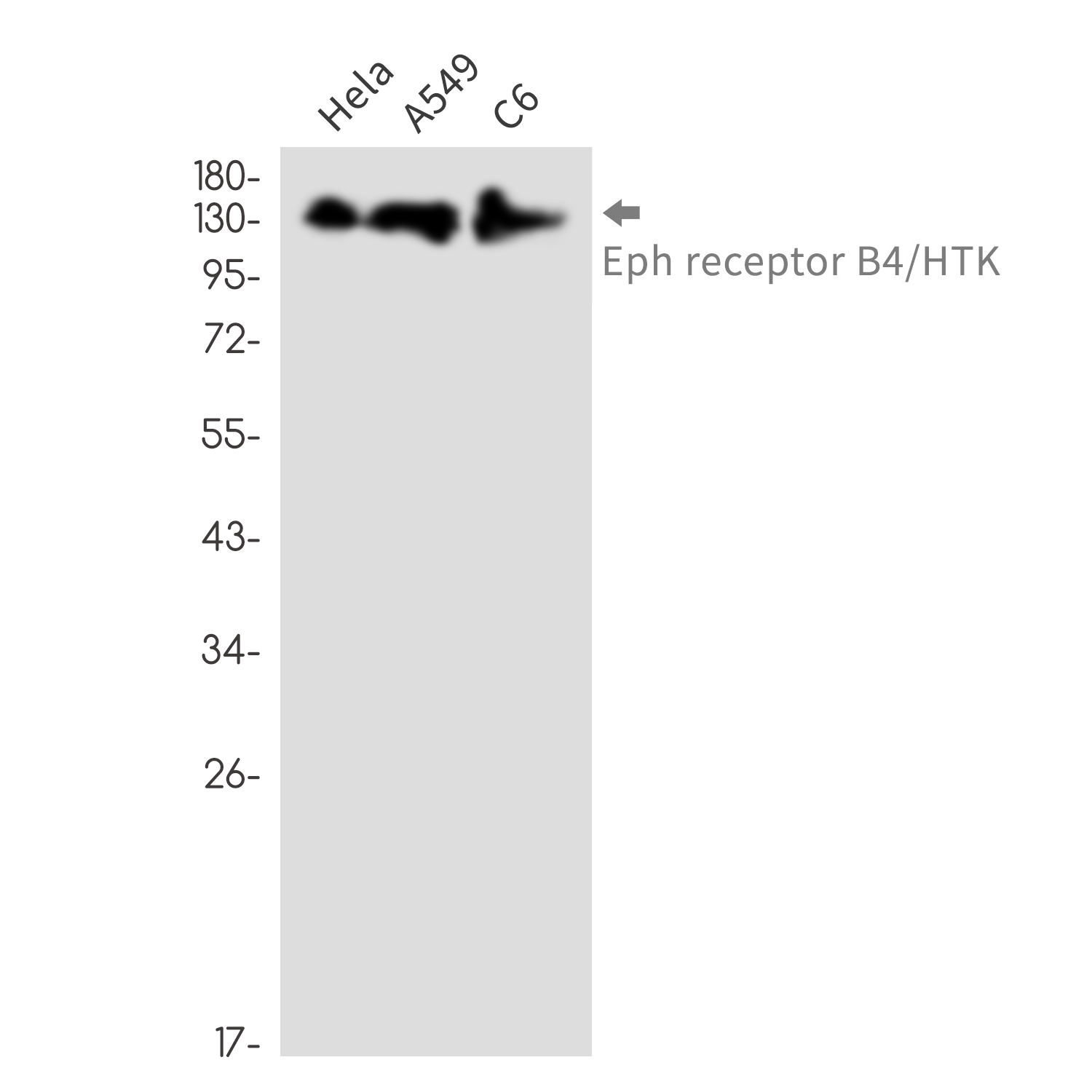 Ephrin Receptor B4 Rabbit mAb