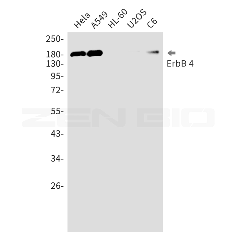 ErbB 4 Rabbit mAb