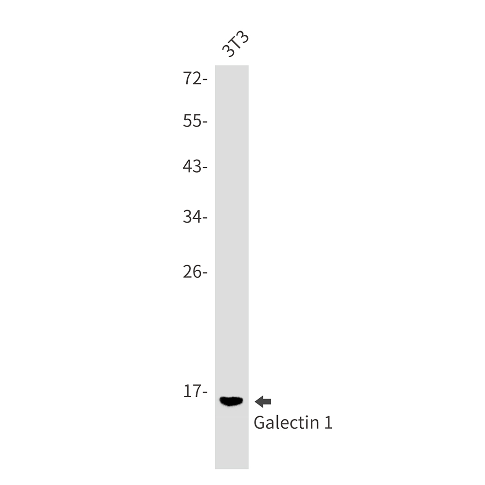 Galectin 1 Rabbit mAb