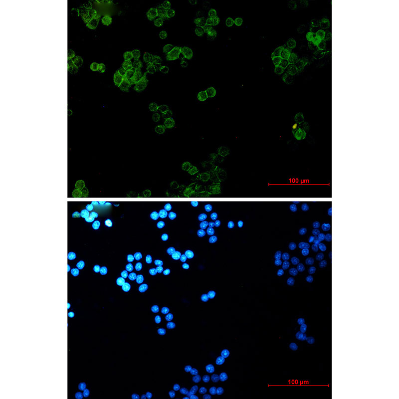 gamma Catenin Rabbit mAb