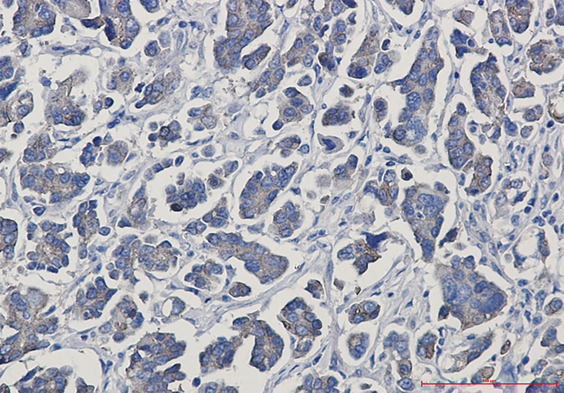 gamma Catenin Rabbit mAb