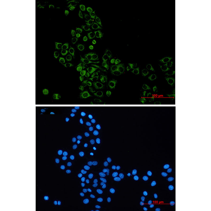 GBP1 Rabbit mAb