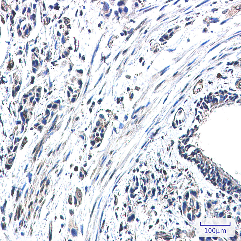 GBP1 Rabbit mAb