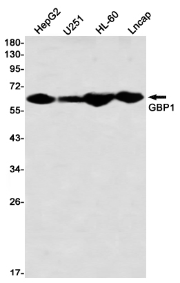 GBP1 Rabbit mAb