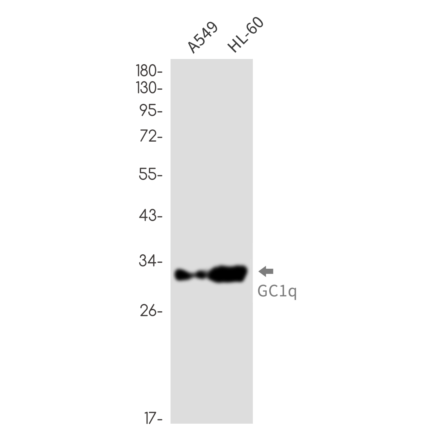 GC1q R Rabbit mAb