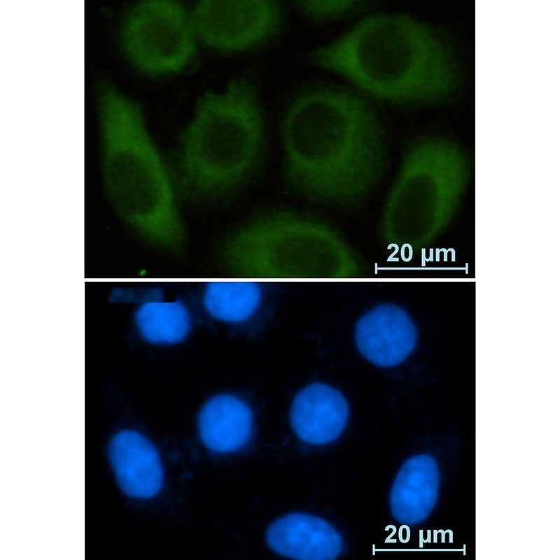 Glucose 6 Phosphate Dehydrogenase Rabbit mAb