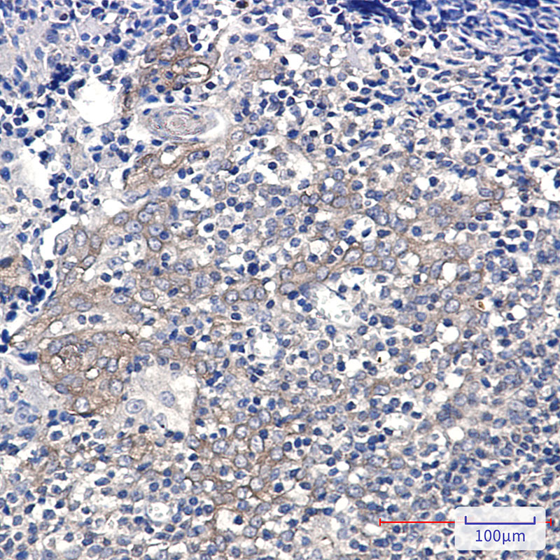 Glucose 6 Phosphate Dehydrogenase Rabbit mAb