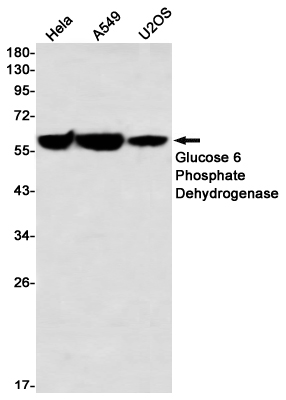 Glucose 6 Phosphate Dehydrogenase Rabbit mAb