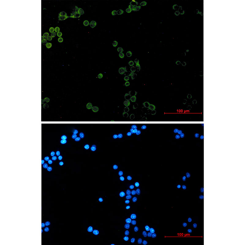 Glutathione Peroxidase 1 Rabbit mAb