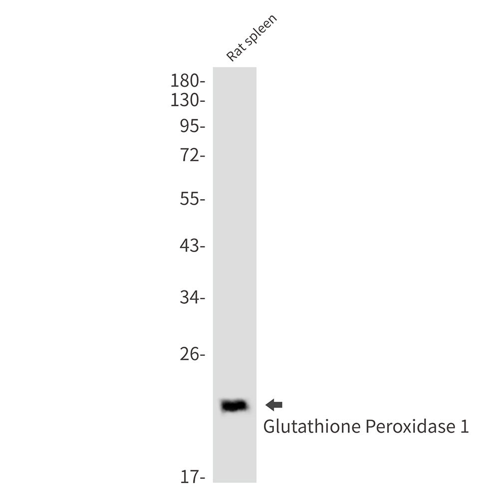 Glutathione Peroxidase 1 Rabbit mAb