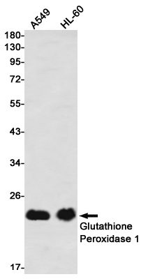 Glutathione Peroxidase 1 Rabbit mAb