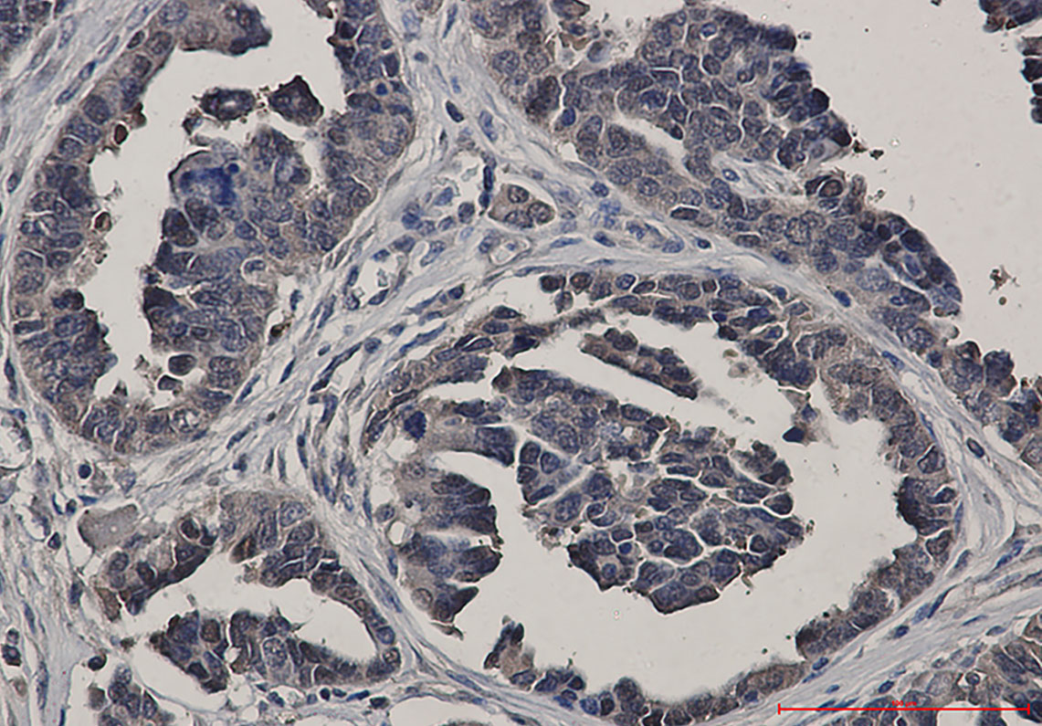 Glutathione Synthetase Rabbit mAb