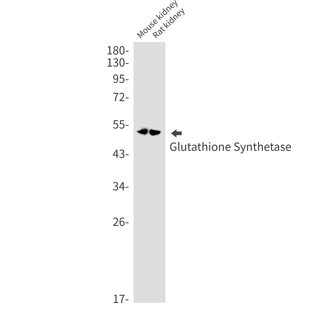 Glutathione Synthetase Rabbit mAb