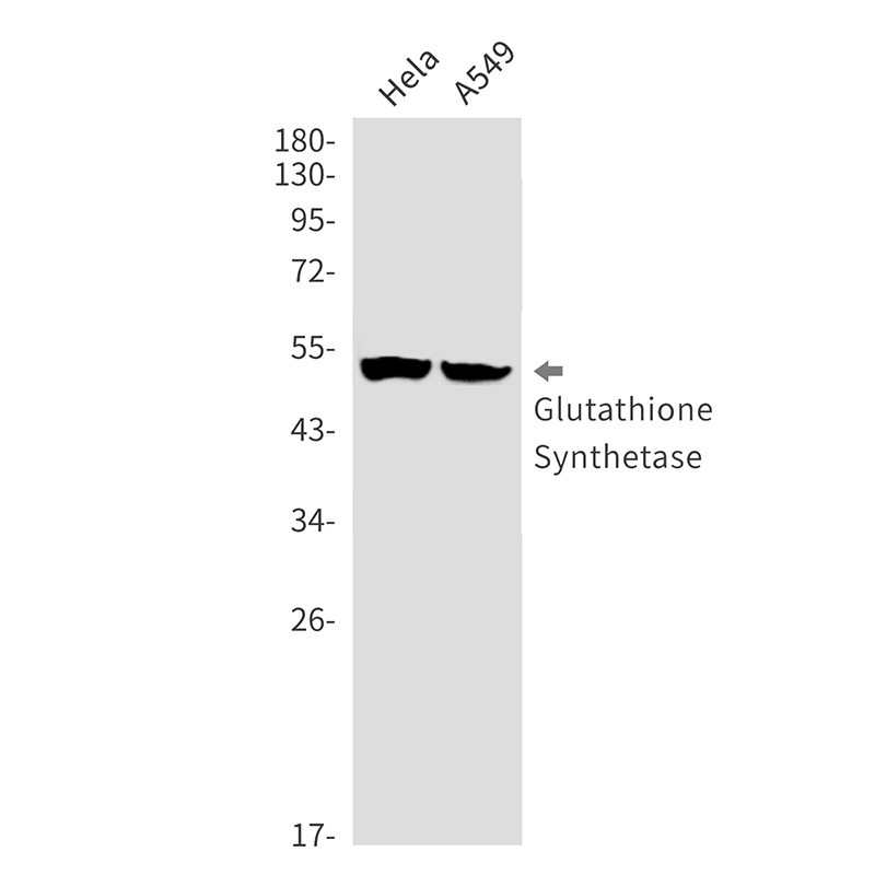 Glutathione Synthetase Rabbit mAb