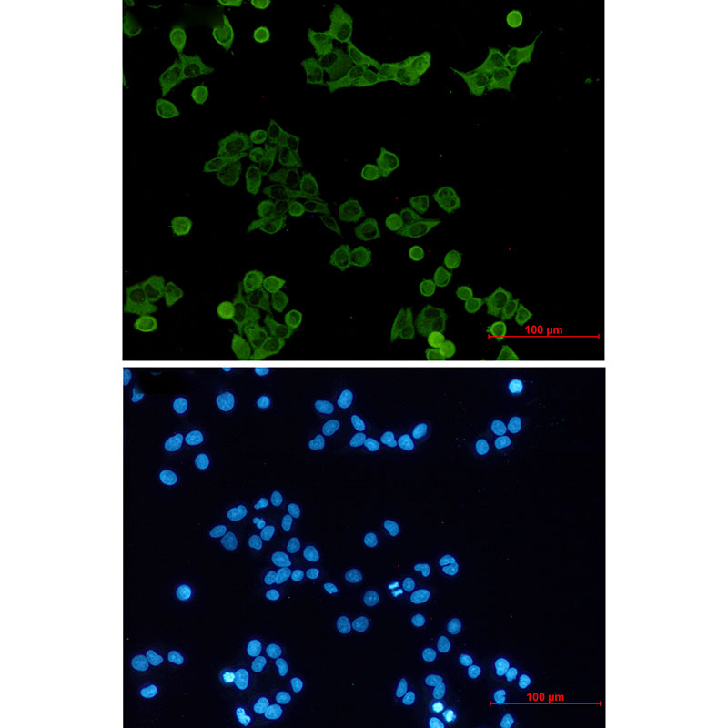 Tyrosine Protein Kinase HCK Rabbit mAb