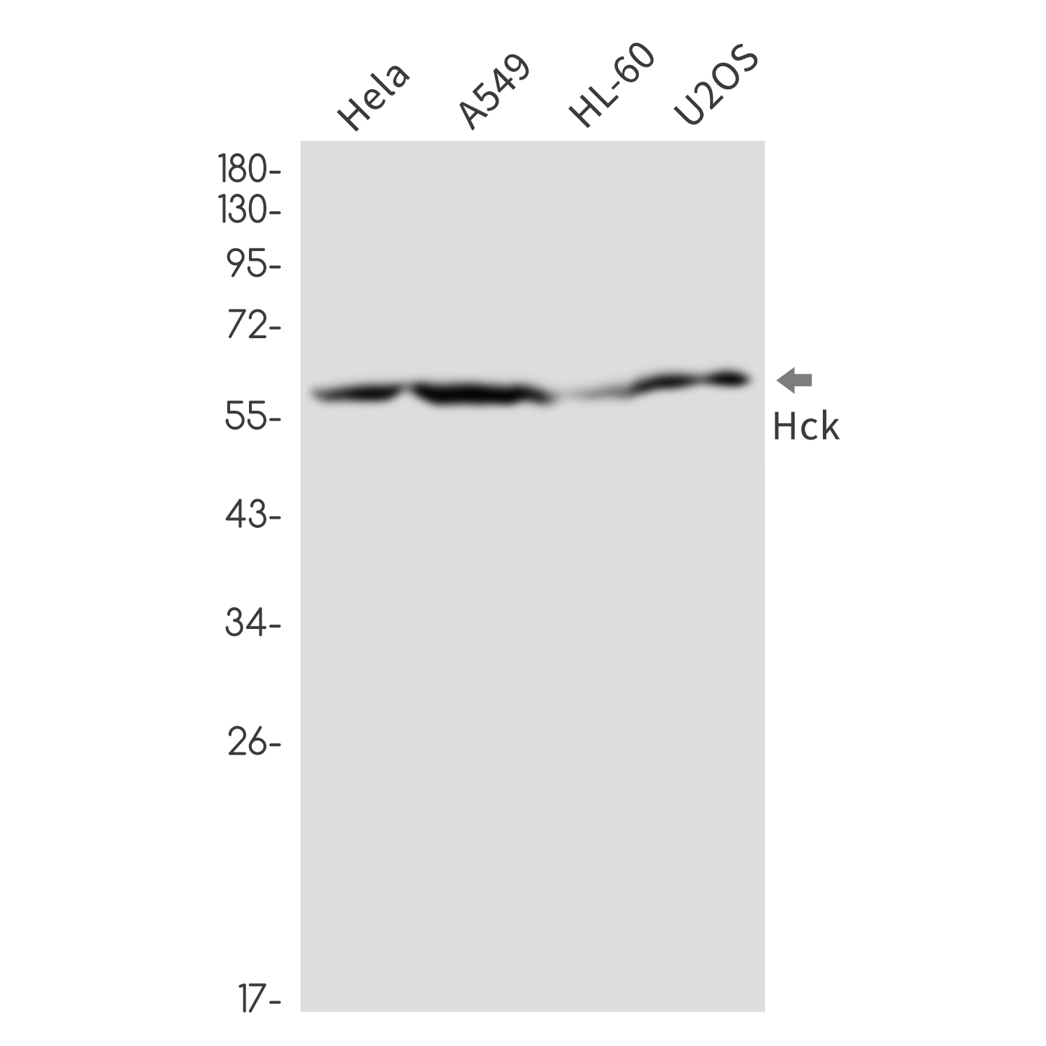 Tyrosine Protein Kinase HCK Rabbit mAb