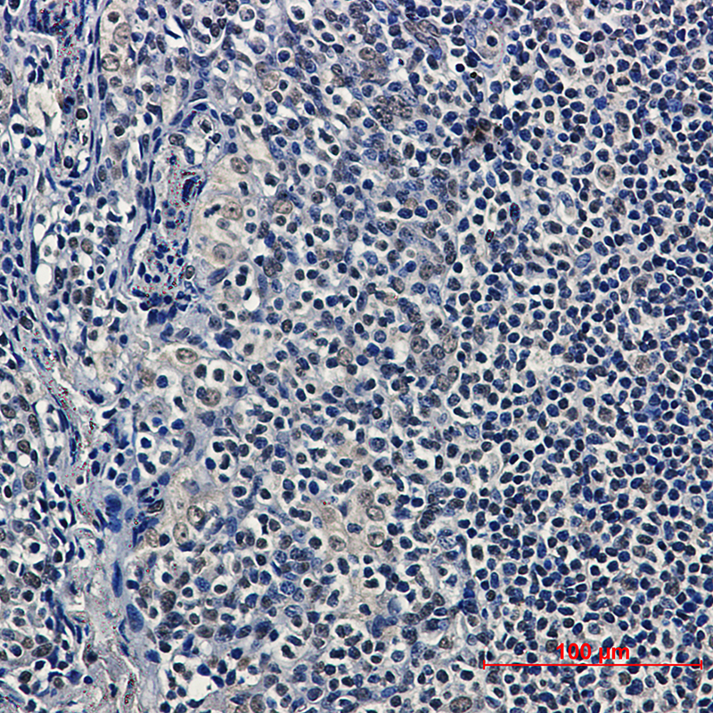 HDAC9 Rabbit mAb