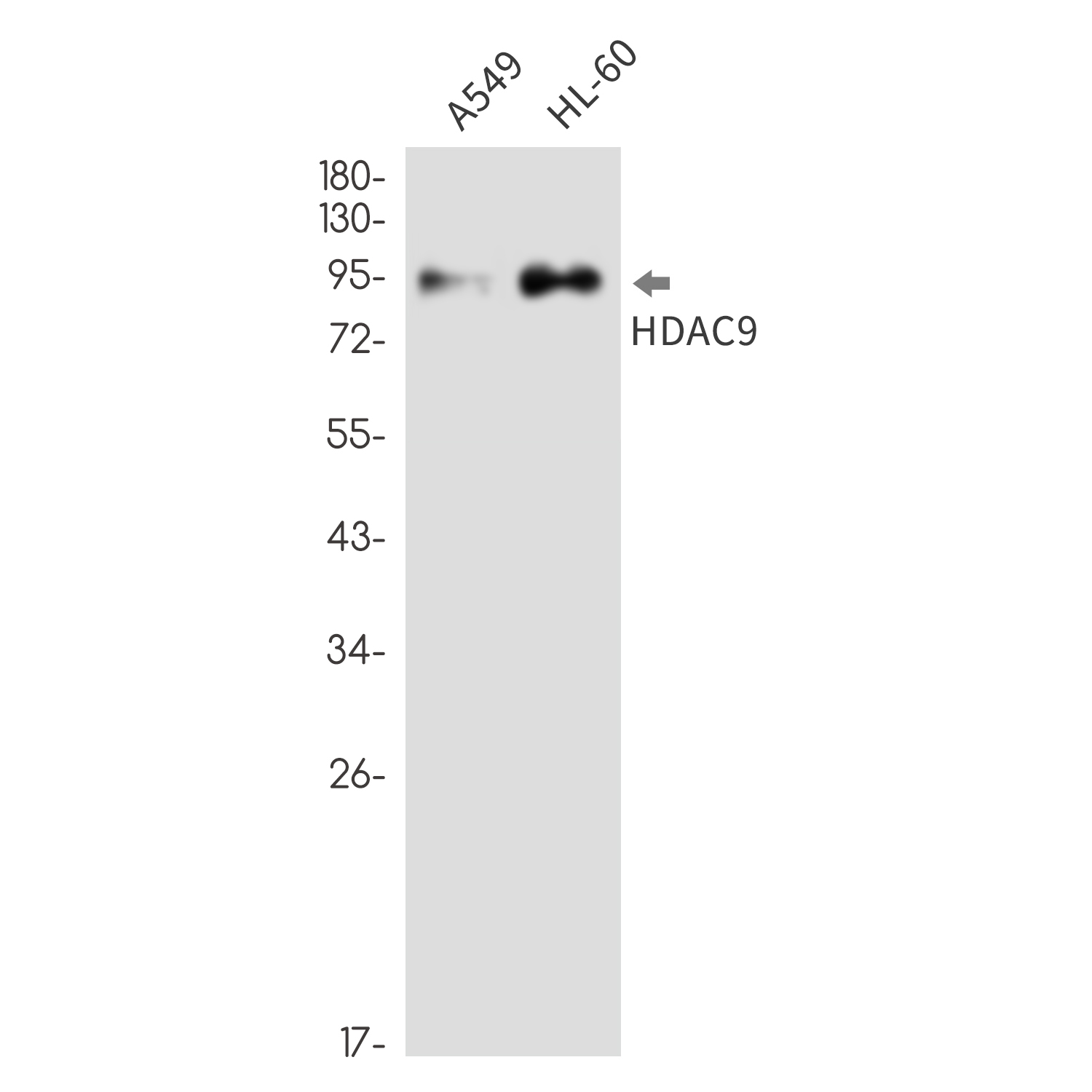 HDAC9 Rabbit mAb