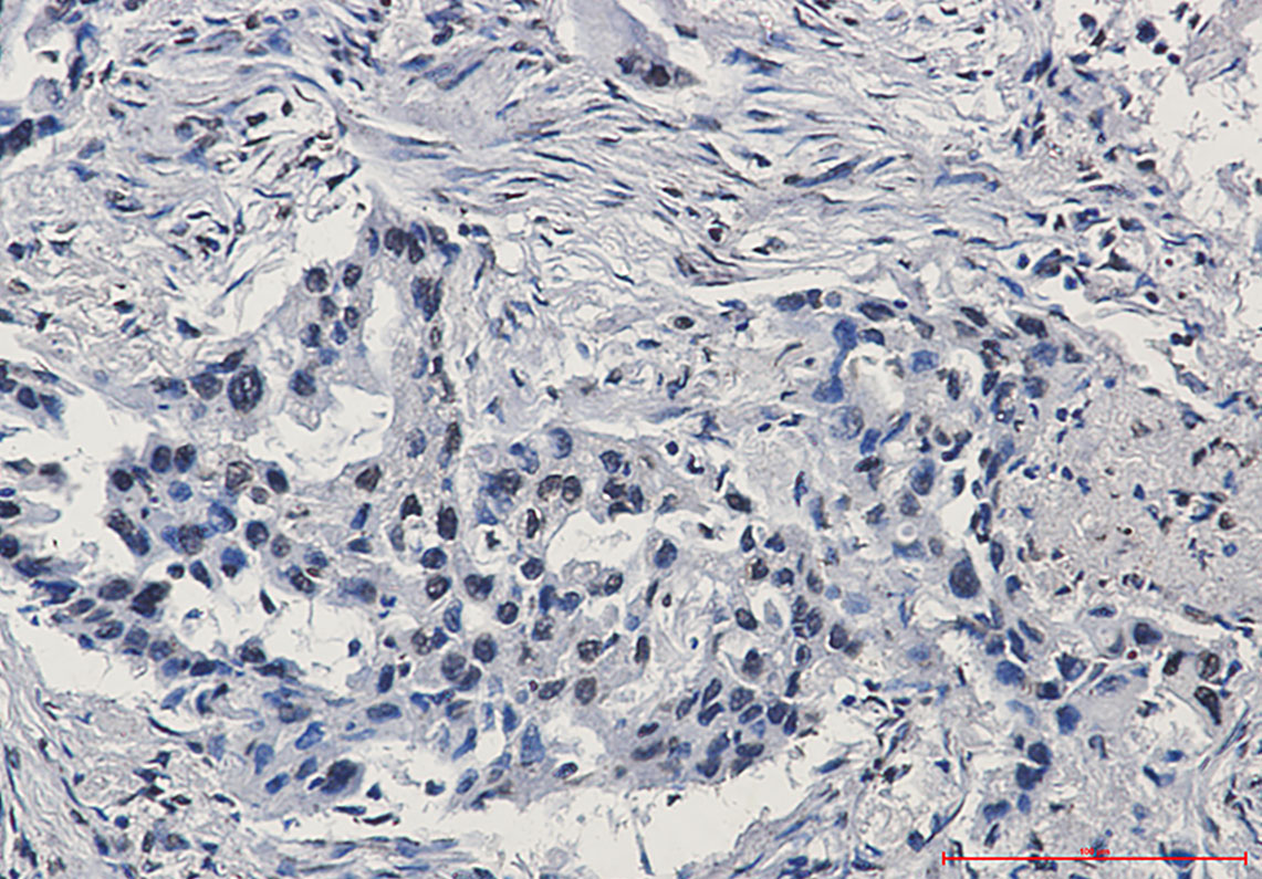 HIF1 beta Rabbit mAb