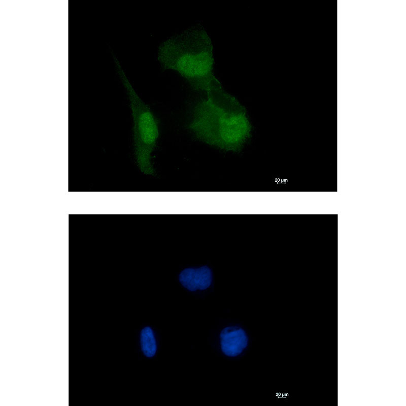 HIF1AN Rabbit mAb