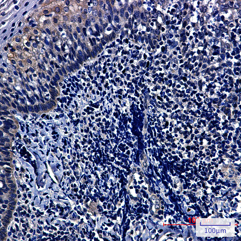 HIF1AN Rabbit mAb